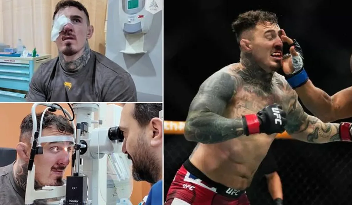 „Nadal nie widzi na to oko” – nowe informacje o stanie zdrowia Toma Aspinalla po faulu Ciryla Gane