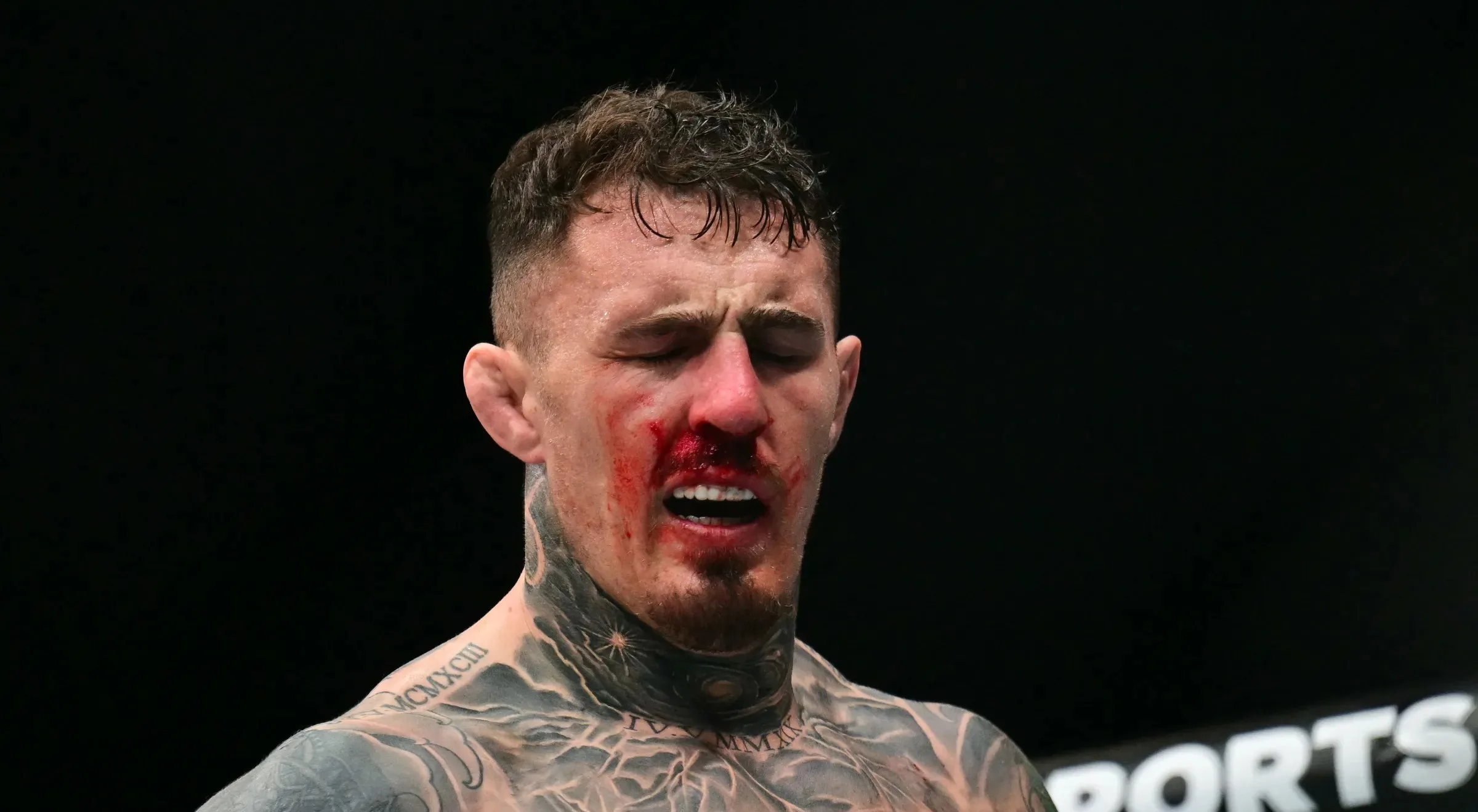 Tom Aspinall zamknął usta hejterom. Mistrz opublikował wyniki badań uszkodzonego oka