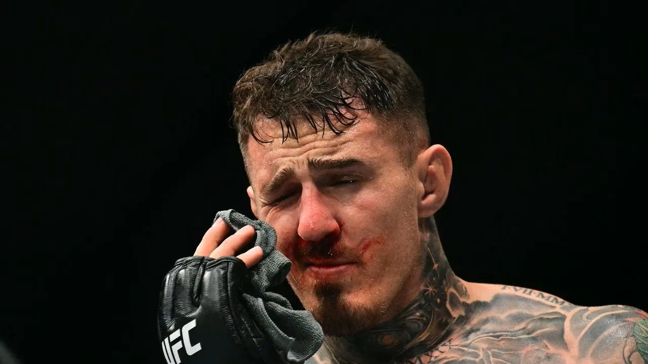 Tom Aspinall ma problem z uściśnięciem dłoni. Tragiczna sytuacja mistrza UFC