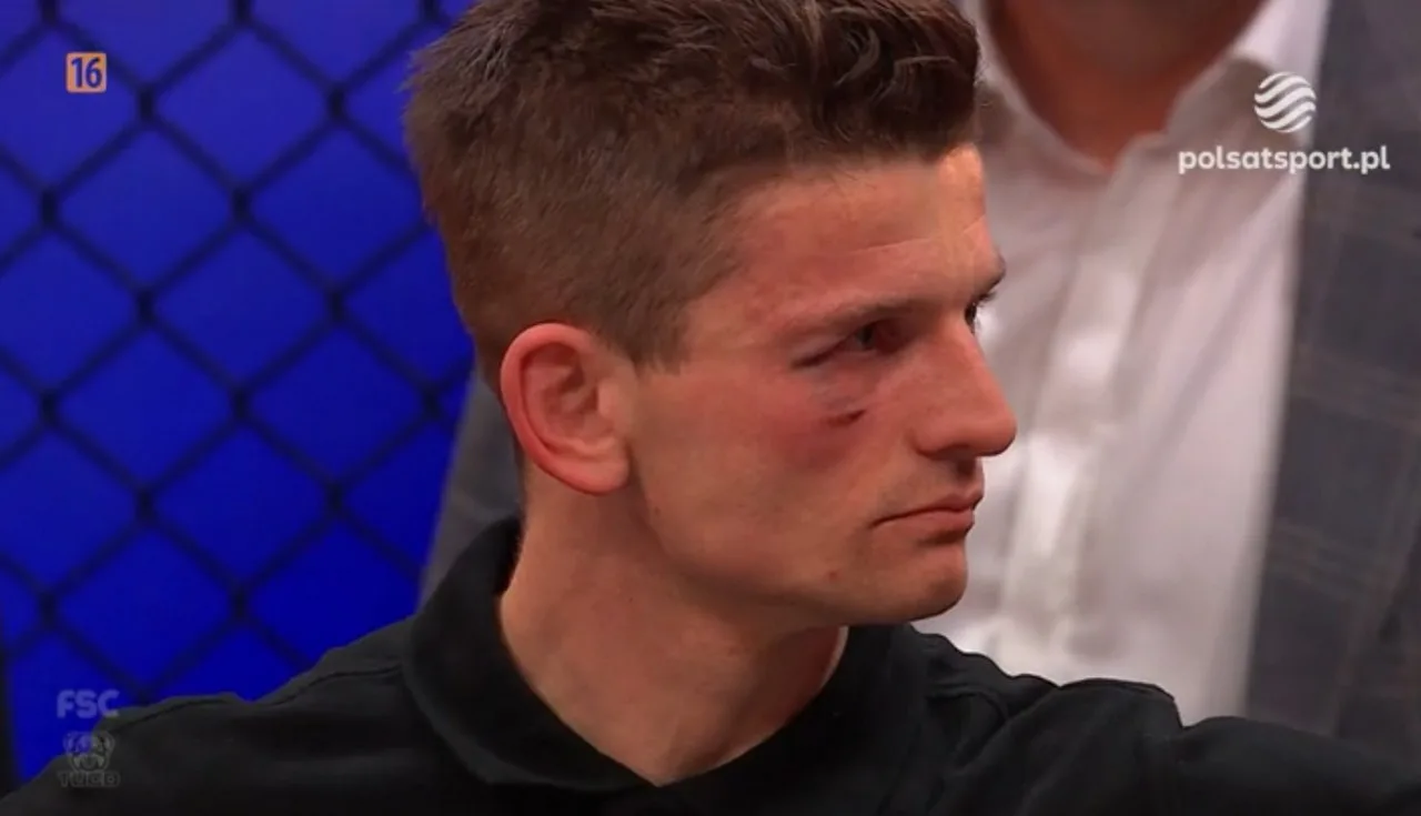 Sędzia uderzony podczas gali w Polsce. Skończyło się na podbitym oku