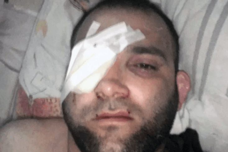 Były zawodnik MMA oskarżony o gwałt na 13-latce brutalnie zatrzymany przez policję, w akcji stracił oko [WIDEO]