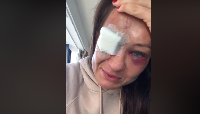 Dramatyczne oświadczenie Karoliny Kowalkiewicz po UFC Auckland: Mogłabym nawet stracić wzrok