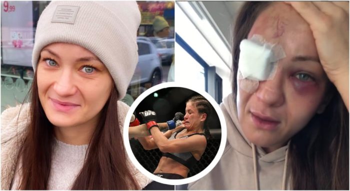 Karolina Kowalkiewicz o kontuzji oka! Dramatyczne wyznanie zawodniczki UFC!