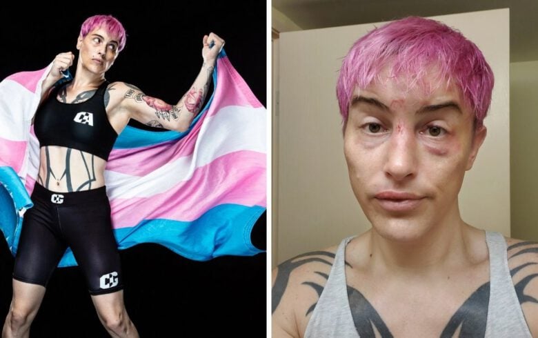 Transseksualista Alana McLaughlin